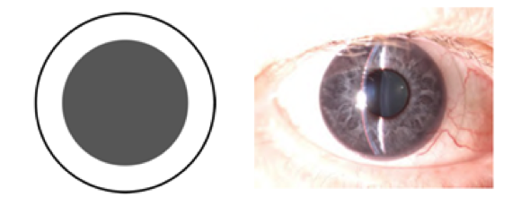 Filterlenzen