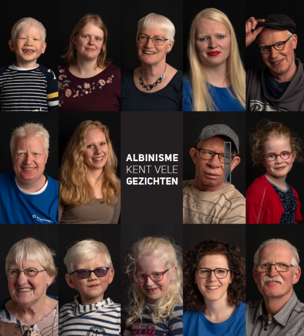Gezichten van 14 mensen met albinisme