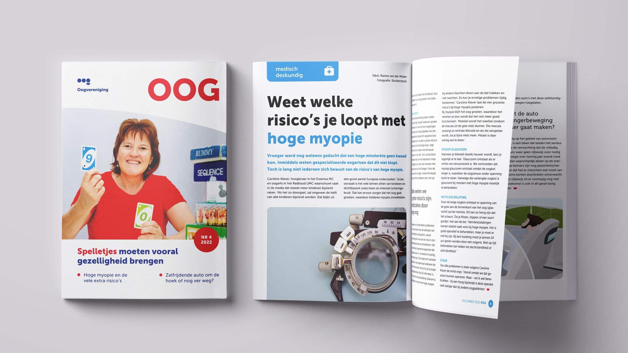 Omslag decembernummer OOG en opengeslagen OOG met artikel met titel: Weet welke risico's je loopt met hoge myopie